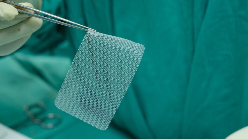 Hernia Mesh Lawsuit